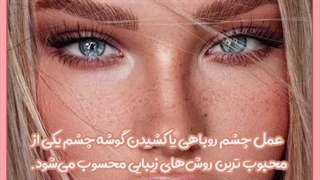 پکیج چشم روباهی سبک روسی