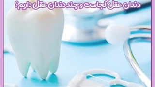 چند دندان عقل داریم؟
