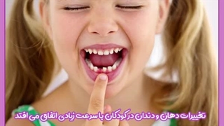 رویش دندان دائمی در ۵ سالگی