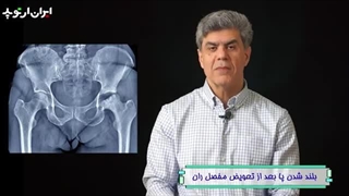 بلند شدن پا بعد از جراحی تعویض مفصل لگن