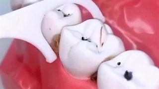 نخ دندان بهتره یا خلال دندان ؟ ( دندانپزشکی شبانه روزی دریا کرج )