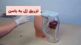 تزریق ژل به باسن لیزر مو