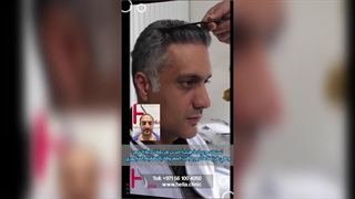 Hair transplant at Helia clinic with written guarantee!