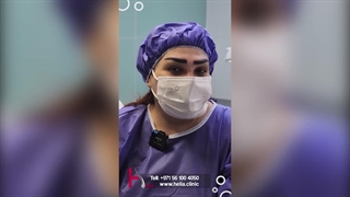 قبل وبعد زراعة الحواجب