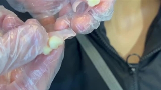 فیلم گذاشتن دندان ژله ای (ثبات داشتن )برای لثه های صاف 09198226524