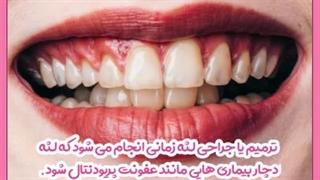 درمان زخم لثه بعد از جراحی