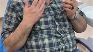 تجربه گذاشتن دندان مصنوعی