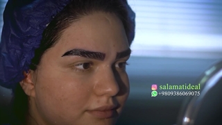 سلامت ایده آل، بهترین کلینیک کاشت ابرو مشهد