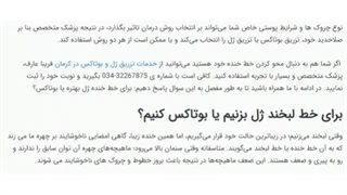 برای خط خنده ژل بهتره یا بوتاکس دندان مصنوعی