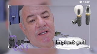 ایمپلنت فول موت