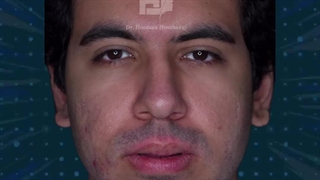 فیلم جراحی دو فک