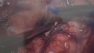 بهبودی سریع فلجی مرد جوان