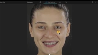 زیبایی دندان و اصلاح طرح لبخند