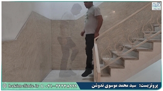 پروتز زیر زانو کربنی (پنجه کربنی پارس فلکس)