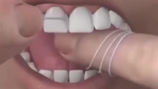 نحوه صحیح نخ دندان کشیدن