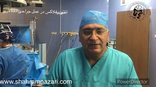 آنتی ریفلاکس در ضمن عمل آشالازی