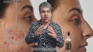 سرم رتینول اصل ضد چروک | آموزش و توضیحات سرم رتینول دندان پیش