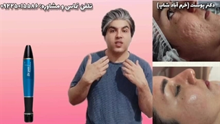 دستگاه دکترپن میکرونیدلینگ بهترین جوانساز عمقی دنیا