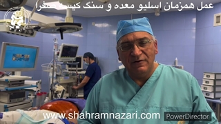 عمل همزمان اسلیو معده و سنگ کیسه صفرا