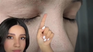 درمان سه مشکل شایع پوست