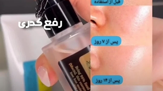 سرم چندکاره از برند کوزارکس