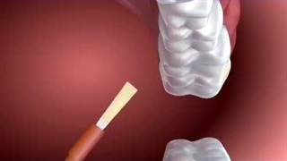 مراقبت از دندان اطفال