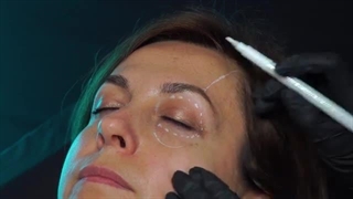 آموزش تزریق جالپرو یانگ آی Young eye Jalupro با کنولا