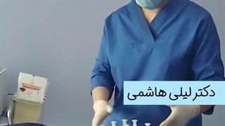 فیلم تزریق چربی - تزریق چربی در تهران