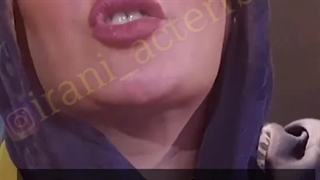 حمیدی لیپوساکشن