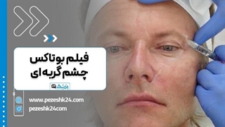 فیلم بوتاکس چشم گربه ای (واقعی)