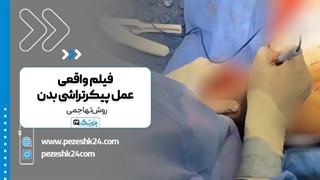 فیلم واقعی پیکرتراشی