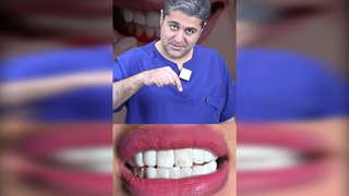 کامپوزیت 100 تومنی