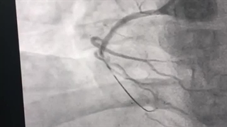 متخصص قلب دکتر محسن فقیهی نیا ساری پلاستیک لثه