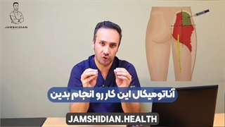 چطور بفهمیم به عصب سیاتیک تزریق کرده ایم؟ | جمشیدیان هلث