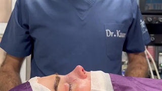 قبل و بلافاصله پس از عمل زیبایی بینی