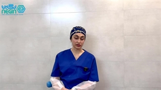 مراقبت های بعد از کامپوزیت دندان | پیشگیری از رنگ گرفتن کامپوزیت ها