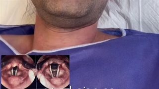 جراح و فوق تخصص حنجره با کارهایی شگفت، دکتر زهرا سرافراز و جراحی تغییر صدا