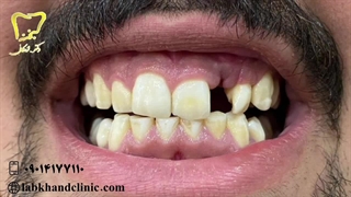 بهترین خدمات دندانپزشکی در کرج