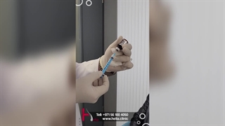 The miraculous effect of hair mesotherapy at Helia Clinic