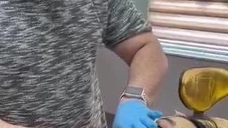 کاشت نخ جوانساز - آموزش لیفت صورت با نخ به زبان ساده