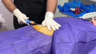 دکتر امین سلیمی لاهیجی. متحصص جراح عمومی کلینیک پوست