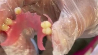 فیلم دندان مصنوعی تکه ای: تحویل 12 ساعته! 09353419752