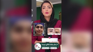 کاشت ابرو از زبان زیباجویان: تاثیرات مثبت و نکات مهم