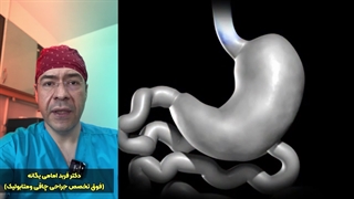 توضیح نحوه انجام عمل اسلیو معده بصورت انیمیشن توسط دکتر فربد امامی یگانه جراحی پف زیر چشم