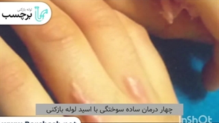 راه های درمان سوختگی در اثر اسید لوله بازکنی