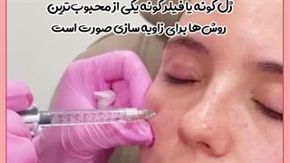 تزریق ژل گونه برای صورت کشیده