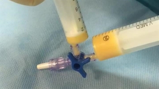 جراحی صدا توسط دکتر مسعود کاظمی بهترین جراح حنجره و صدا در ایران