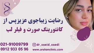 رضایت زیباجوی عزیز پس از کانتورینگ صورت و فیلرلب