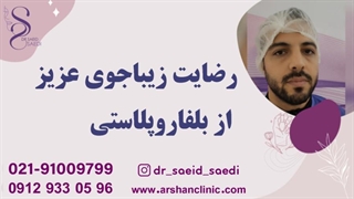 رضایت زیباجوی عزیز از بلفاروپلاستی