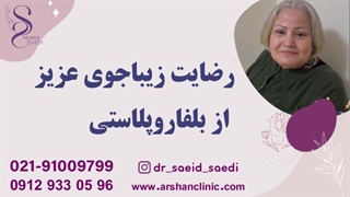 رضایت زیباجوی عزیز از بلفاروپلاستی